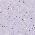 Anti-FAM124B Antibody