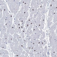 Anti-RBM20 Antibody