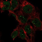 Anti-LRRTM3 Antibody