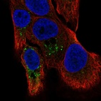 Anti-TMBIM1 Antibody