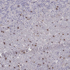 Anti-OPRD1 Antibody