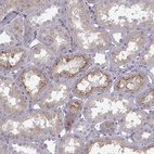 Anti-OPRD1 Antibody