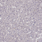 Anti-OPRD1 Antibody