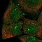 Anti-CPEB3 Antibody