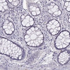 Anti-WFDC8 Antibody