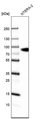 Anti-SLCO1A2 Antibody