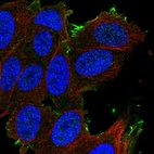 Anti-SLCO1A2 Antibody