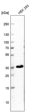 Anti-SCAMP3 Antibody