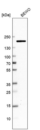 Anti-DOT1L Antibody