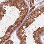 Anti-FAF2 Antibody