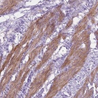 Anti-MBLAC1 Antibody