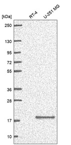 Anti-RPS23 Antibody