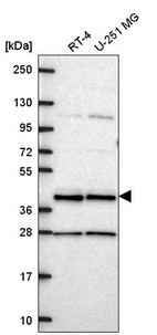 Anti-CCDC84 Antibody