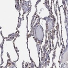 Anti-LIMD1 Antibody