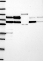 Lane 1: Marker [kDa] 250, 130, 95, 72, 55, 36, 28, 17, 10 | Lane 2: RT4 | Lane 3: U-251 MG | Lane 4: Human Plasma | Lane 5: Liver | Lane 6: Tonsil