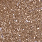 Anti-SMIM17 Antibody