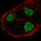 Anti-GPR161 Antibody