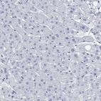 Immunohistochemical staining of human liver shows low expression as expected.