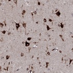 Anti-EPDR1 Antibody