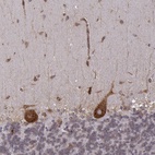 Anti-TMEM14A Antibody