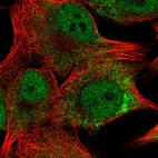 Immunofluorescent staining of human cell line SK-MEL-30 shows localization to nucleoplasm & endoplasmic reticulum.