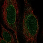 Anti-NRM Antibody