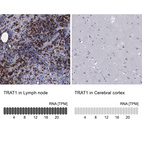 Anti-TRAT1 Antibody