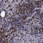 Anti-TRAT1 Antibody