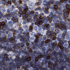 Anti-TRAT1 Antibody