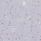 Anti-TRAT1 Antibody