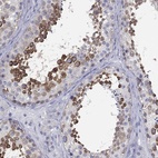 Anti-STK31 Antibody