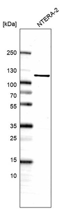 Anti-JADE1 Antibody