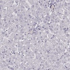 Anti-TMPRSS15 Antibody