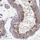 Anti-DUSP7 Antibody