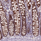 Anti-ARL1 Antibody