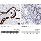 Anti-TMEM40 Antibody