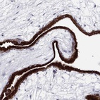 Anti-TMEM40 Antibody