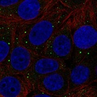 Anti-THBS3 Antibody