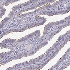 Anti-KIF19 Antibody