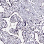 Anti-KIF19 Antibody