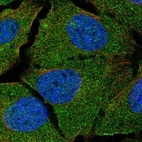 Anti-TGFB1 Antibody