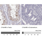 Anti-C16orf86 Antibody