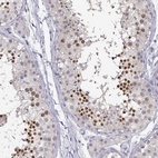 Anti-C16orf86 Antibody