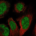 Anti-PBXIP1 Antibody