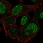 Anti-CABLES1 Antibody