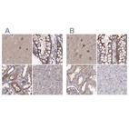 Anti-PLEKHG3 Antibody