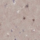 Anti-PLEKHG3 Antibody