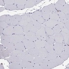 Anti-CCL27 Antibody