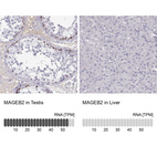 Immunohistochemistry analysis in human testis and liver tissues using HPA074544 antibody. Corresponding MAGEB2 RNA-seq data are presented for the same tissues.