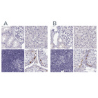 Immunohistochemical staining of human kidney, liver, lymph node and testis using Anti-MAGEB2 antibody HPA074544 (A) shows similar protein distribution across tissues to independent antibody HPA075519 (B).